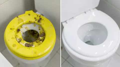 czym wyczyścić żółtą deskę sedesową